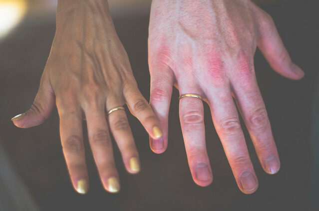 wedding rings